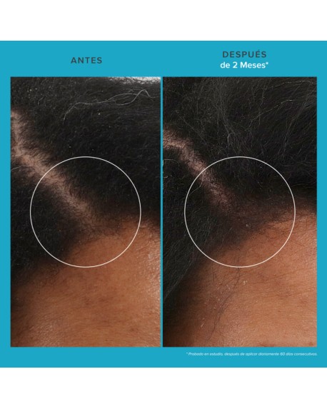 SCALP CARE REVITALIZING TREATMENT